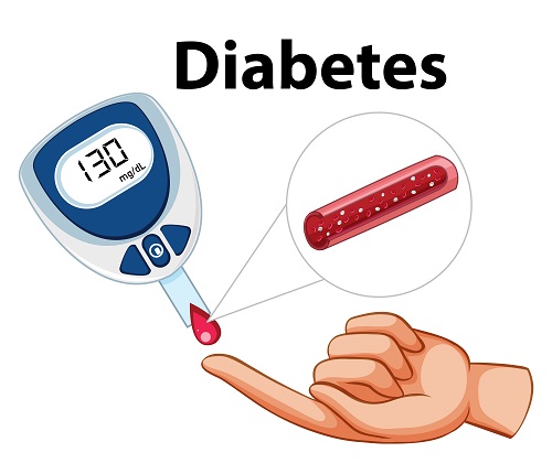 Illustration of a diabetes glucose test showing 130 mg/dL with a blood drop from a finger and a magnified view of a blood vessel.