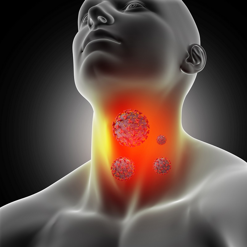 3D model of a man showing a sore throat with visible coronavirus cells.