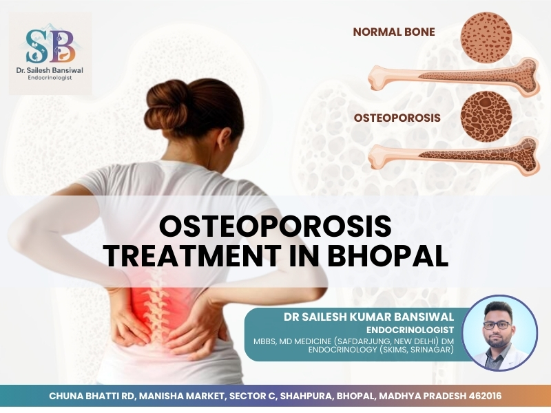 Osteoporosis treatment in Bhopal showing weak bone vs normal bone structure with back pain symptoms explained by endocrinologist Dr. Sailesh Kumar Bansiwal
